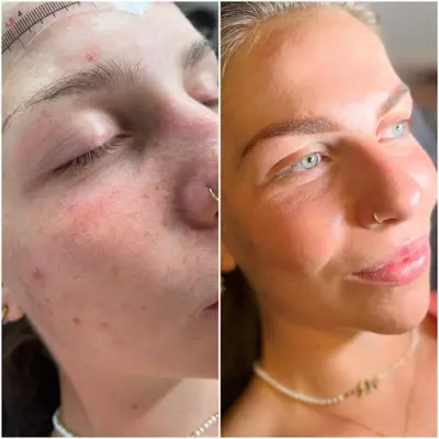 GK beauty clinic botox Almelo