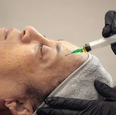 Wonder Skin Clinic botox Berlicum