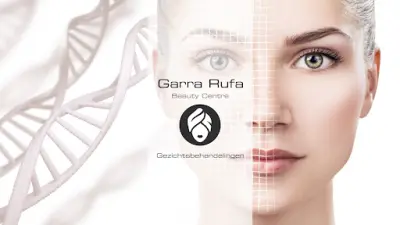Garra Rufa Beauty Centre Beverwijk botox Beverwijk
