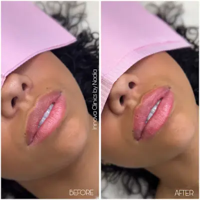 Innova Clinics by Nadia botox Breda