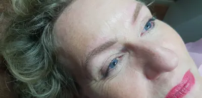 Beautystudio X-Style botox Drenthe