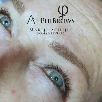 SILKY SMOOTH botox Den Helder
