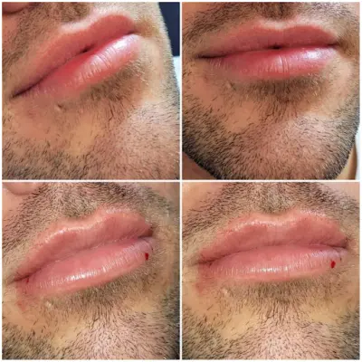 By louise botox Dinteloord