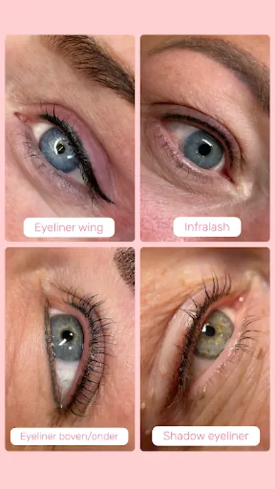 Y-browstudio botox Enkhuizen