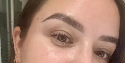 Elva Beauty Clinic botox Geleen