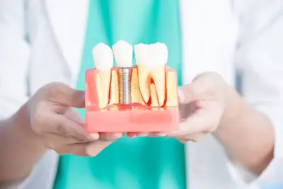 Tandartsenpraktijk Grave / Expertise Kliniek voor Implantologie Grave botox Grave
