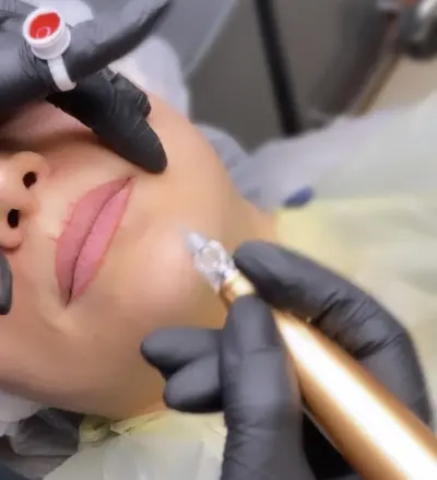 Meshki Beauty botox Hedel