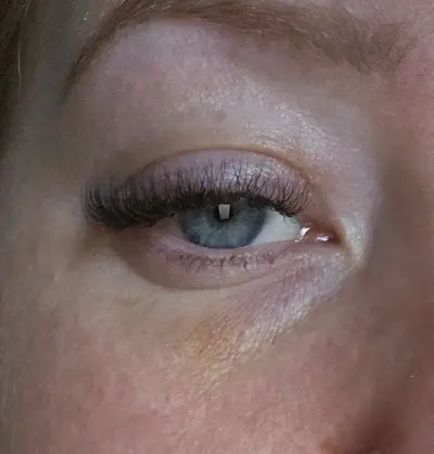 Hi Beauty botox Helmond