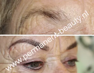 Permanent Beauty botox Kerkrade