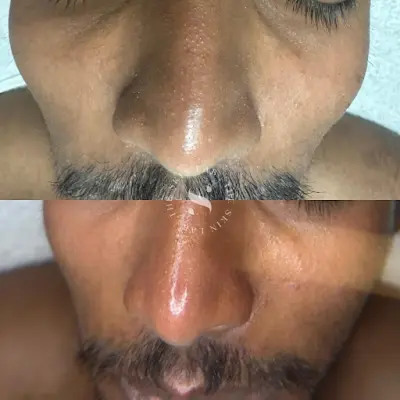 The SkinLab botox Landgraaf