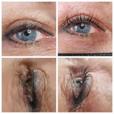 Sunday botox Maassluis