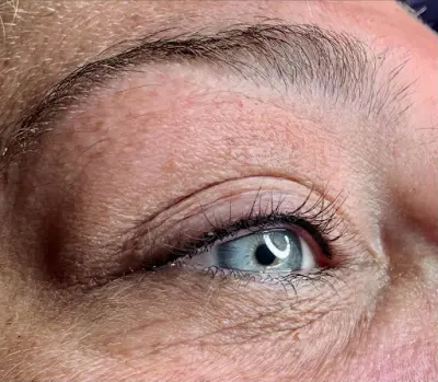 Skin & ink botox Schijndel