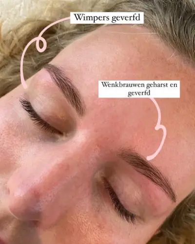 SILK Schoonheidssalon botox Varsseveld