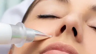 Secrets of beauty botox Groningen