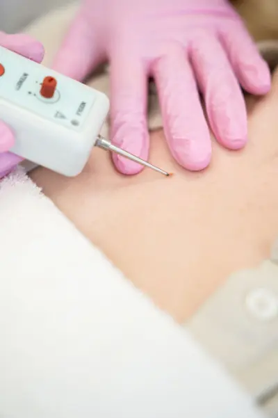 Huidkliniek de Vallei botox Veenendaal
