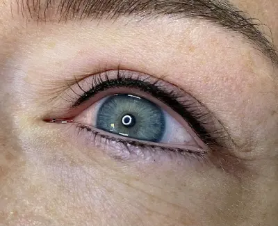 MoreITZ Beautysalon botox Veenendaal