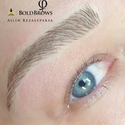 beautykliniek weesp botox Weesp