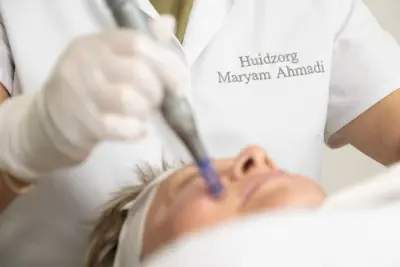 Huidzorg Zwijndrecht botox Zwijndrecht